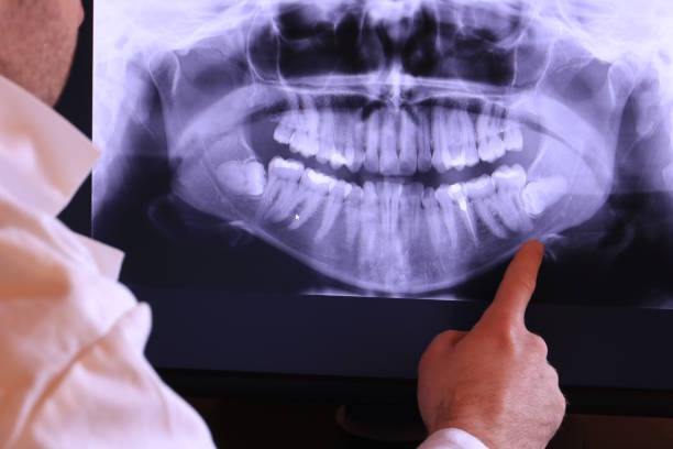 Best Emergency Broken Tooth Repair in Selmer, TN