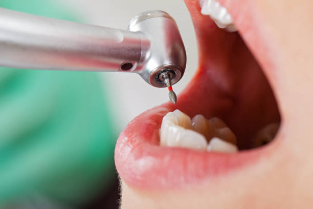 Best Walk-In Emergency Dentist in Selmer, TN